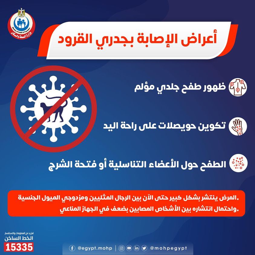 الصحة تكشف أعراض وحقيقة انتشار جدري القرود.. غير موجود في مصر